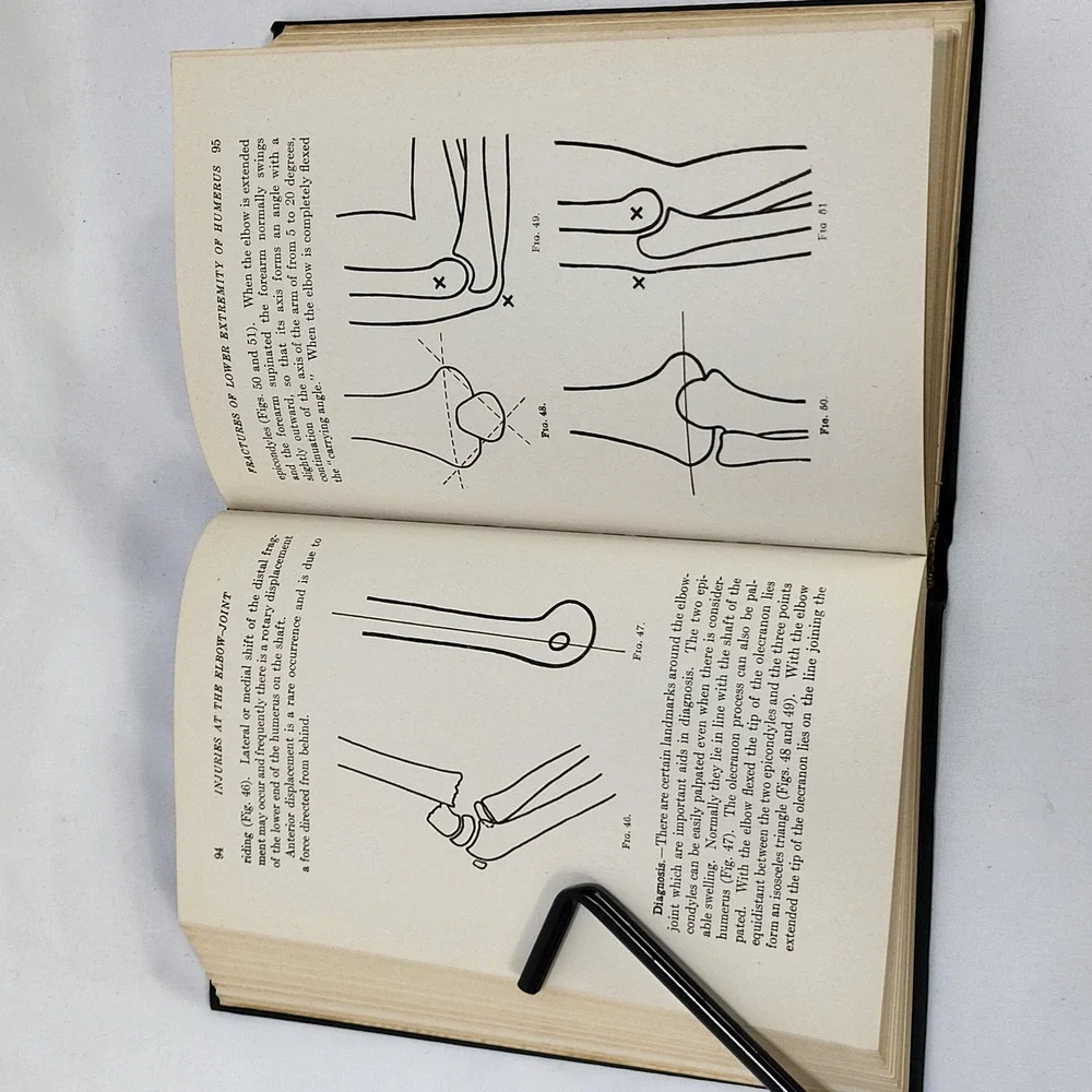 1947 A Manual of Fractures and Dislocations Barbara Stimson 2nd Ed Medical Book